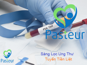 ​Sàng lọc ung thư tuyến tiền liệt