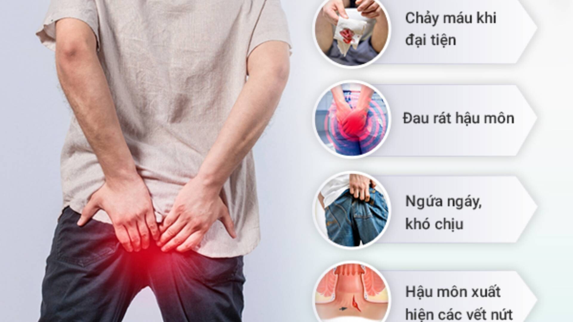 Nứt kẽ hậu môn: Nguyên nhân và triệu chứng cần biết Ảnh minh họa
