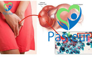 Bệnh Chlamydia ở nam và nữ giới những điều bạn cần biết Ảnh minh họa