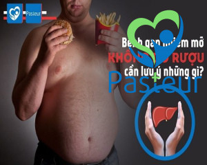 Bệnh gan nhiễm mỡ không do rượu Ảnh minh họa