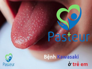 Bệnh Kawasaki ở trẻ em là gì? nguyên nhân và triệu chứng Ảnh minh họa