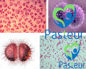 Lậu cầu là gì?