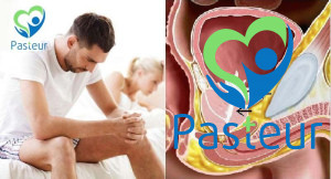 Xuất tinh ngược dòng: Triệu chứng và nguyên nhân Ảnh minh họa