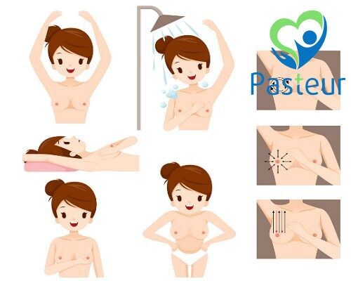 Tự Khám Vú Trong Tầm Soát Ung Thư Vú Ảnh minh họa