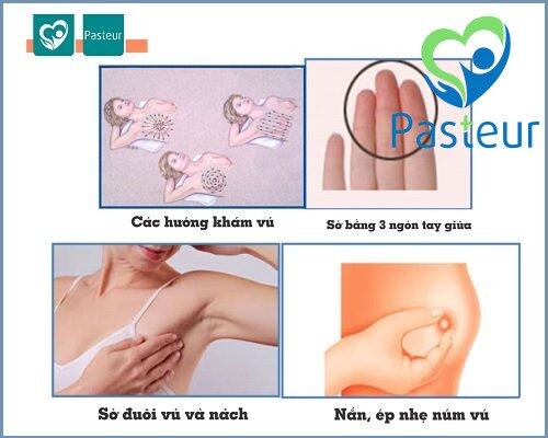 Tự Khám Vú Trong Tầm Soát Ung Thư Vú Ảnh minh họa