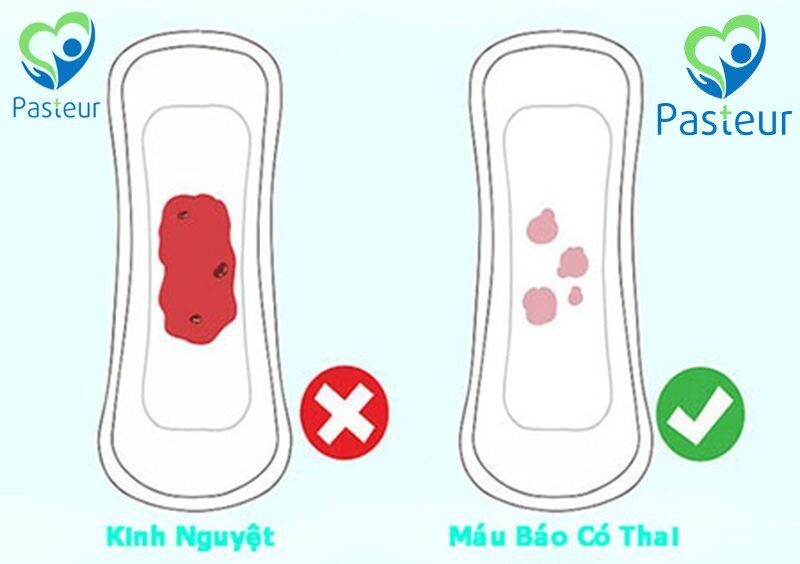 Dấu hiệu mang thai: Những dấu hiệu để nhận biết rằng bạn đã có thai Ảnh minh họa