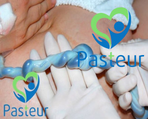 Dây Rốn Thắt Nút - Mối Nguy Hiểm Hiếm Gặp Nhưng Đáng Sợ Ảnh minh họa