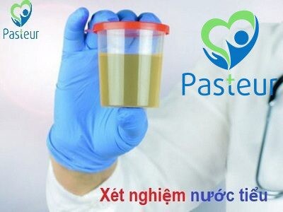 Nhiễm trùng đường tiểu ở trẻ em - Triệu chứng và cách điều trị 3 Nhiễm trùng đường tiểu ở trẻ em - Triệu chứng và cách điều trị Ảnh minh họa