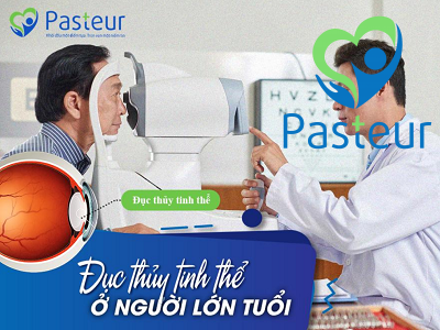 Đục thủy tinh thể là gì