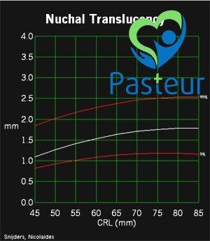 SIÊU ÂM ĐO ĐỘ MỜ DA GÁY ĐỂ LÀM GÌ- MẸ BẦU CẦN NÊN ĐỌC 3 SIÊU ÂM ĐO ĐỘ MỜ DA GÁY ĐỂ LÀM GÌ- MẸ BẦU CẦN NÊN ĐỌC Ảnh minh họa