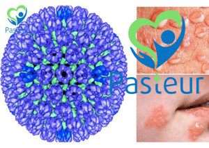 Mụn Rộp Sinh Dục: Nguyên nhân, triệu chứng và cách khắc phục Ảnh minh họa