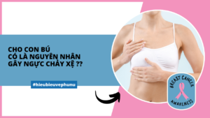 Cho con bú có phải là nguyên nhân chính gây ngực chảy xệ Ảnh minh họa