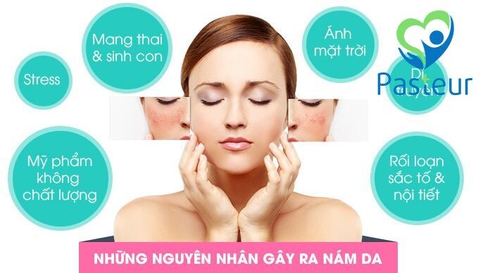nguyen nhan gay ra nam da
