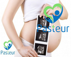 Siêu âm thai nhi và các cột mốc quan trọng mẹ cần nắm rõ Ảnh minh họa