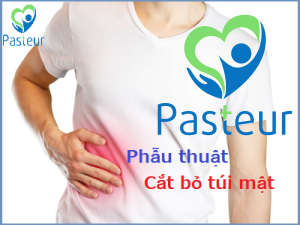 Phẫu thuật cắt bỏ túi mật như thế nào Ảnh minh họa