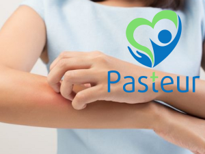 Nổi mề đay là gì? Các dấu hiệu, nguyên nhân và điều trị Ảnh minh họa