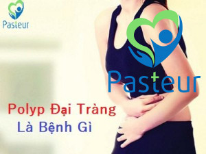 Polyp đại tràng là gì - Các triệu chứng và cách phát hiện Ảnh minh họa