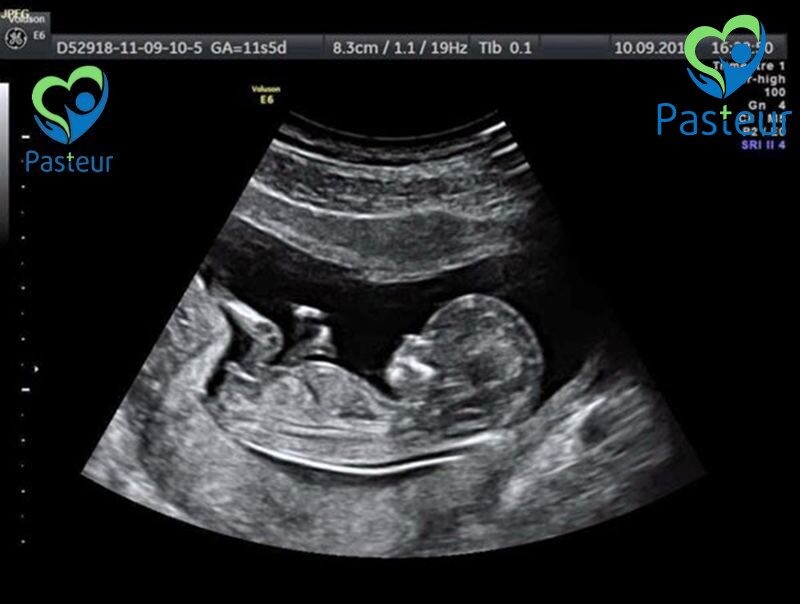 Siêu âm thai là gì? Giải đáp các vấn đề về siêu âm thai Ảnh minh họa