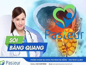 Tìm hiểu về sỏi bàng quang - Các triệu chứng cần biết Ảnh minh họa