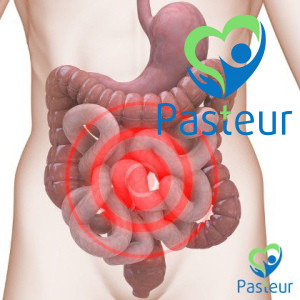 Tìm hiểu hội chứng ruột kích thích (IBS) là gì bạn nên biết Ảnh minh họa