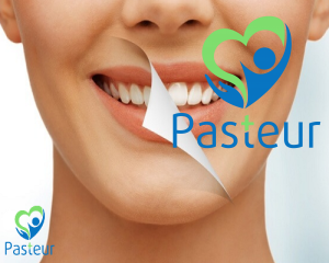 Tẩy trắng răng có ảnh hưởng đến sức khỏe răng miệng không? Ảnh minh họa