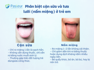 Trẻ Sơ Sinh Bị Trắng Lưỡi: Nguyên Nhân, Cách Xử Lý & Phòng Ngừa Hiệu Quả Ảnh minh họa