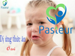 Dị ứng thức ăn ở trẻ nhỏ và trẻ sơ sinh phải làm sao? Ảnh minh họa