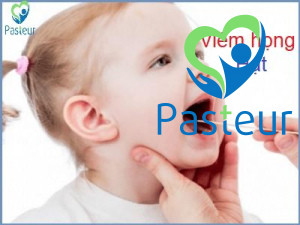 Viêm họng hạt ở trẻ em? Dấu hiệu và cách phòng tránh Ảnh minh họa