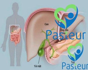 Viêm Tụy Cấp và Mãn Tính: Nguyên Nhân, Triệu Chứng, Chẩn Đoán và Điều Trị Hiệu Quả Ảnh minh họa