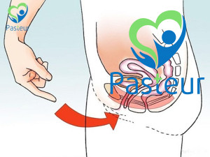 Xuất tinh ngược dòng: Chẩn đoán và điều trị Ảnh minh họa