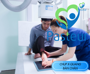 CHỤP X-QUANG BÀN CHÂN Ảnh minh họa