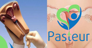 Đặt vòng tránh thai là gì?