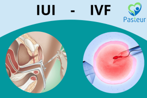 Sự khác nhau giữa IUI và IVF