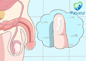 Bệnh lậu ở nam giới