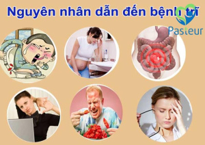 Nguyên nhân gây ra bệnh trĩ