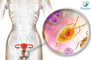 Âm đạo bị viêm do trùng rọi Trichomonas