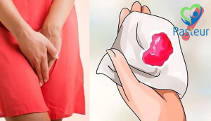 Chảy máu tiền mãn kinh