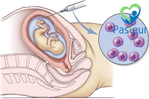 Phương pháp lấy mẫu nhung mao màng đệm