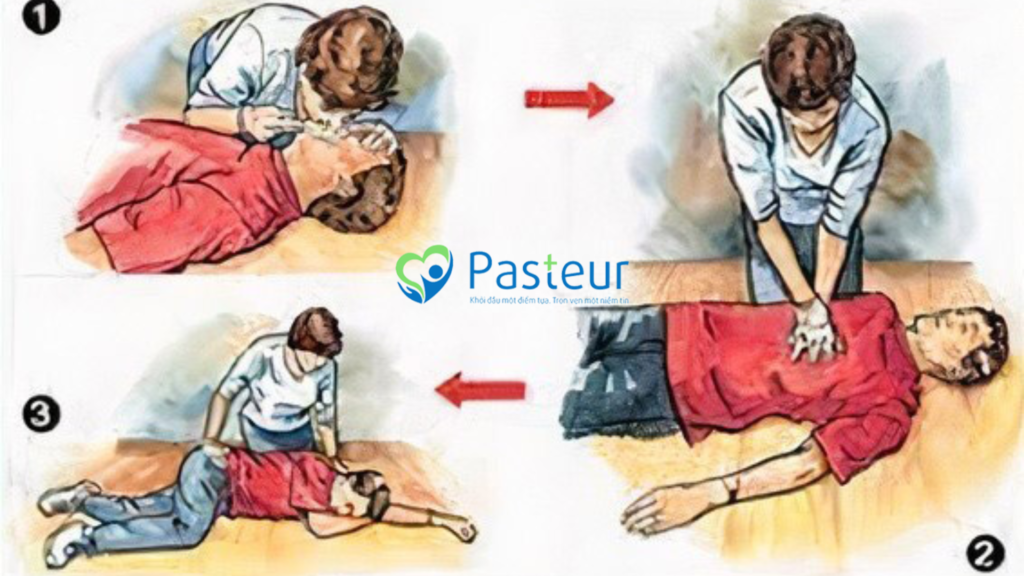 CẦN LÀM GÌ KHI THẤY CÓ NGƯỜI BỊ ĐỘT QUỴ Ảnh minh họa