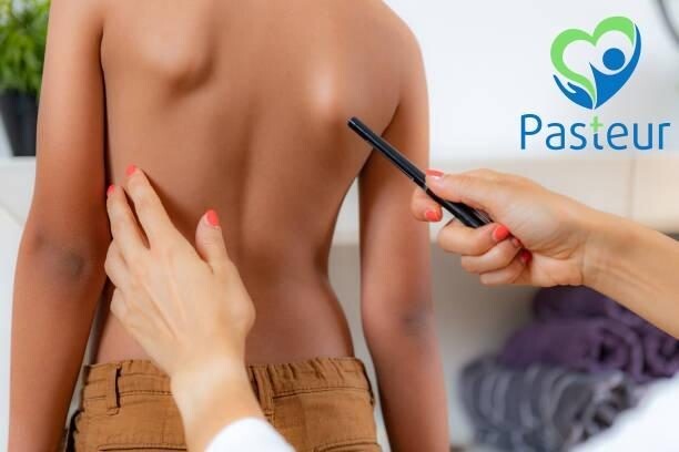 Triệu chứng của vẹo cột sống