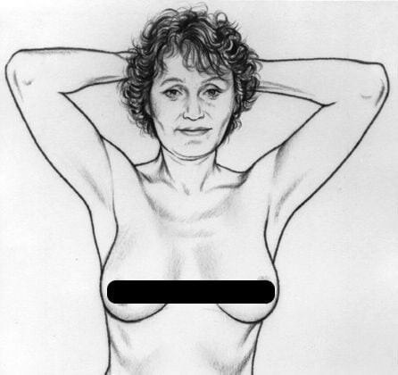 Hướng dẫn 5 bước tự kiểm tra vú tại nhà để phòng ngừa ung thư vú 2 Hướng dẫn 5 bước tự kiểm tra vú tại nhà để phòng ngừa ung thư vú Ảnh minh họa