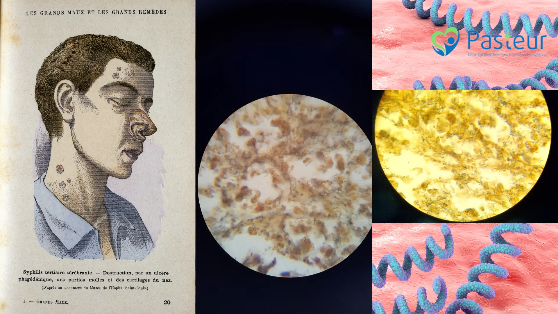 9 bệnh lý lây truyền qua đường tình dục thường gặp Ảnh minh họa