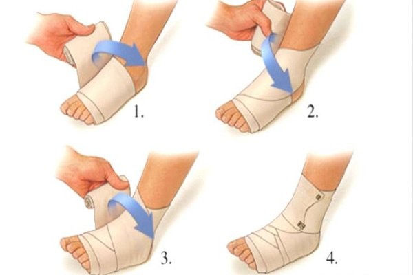 CÁCH XỬ LÝ KHI BỊ LẬT SƠ MI CỔ CHÂN NHƯ THẾ NÀO CHO ĐÚNG? CÁCH XỬ LÝ KHI BỊ LẬT SƠ MI CỔ CHÂN NHƯ THẾ NÀO CHO ĐÚNG?