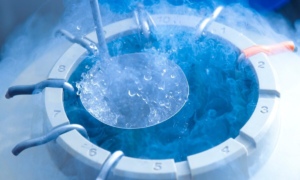 Ngân hàng trứng – giải pháp cho phụ nữ vô sinh hiếm muộn Ảnh minh họa