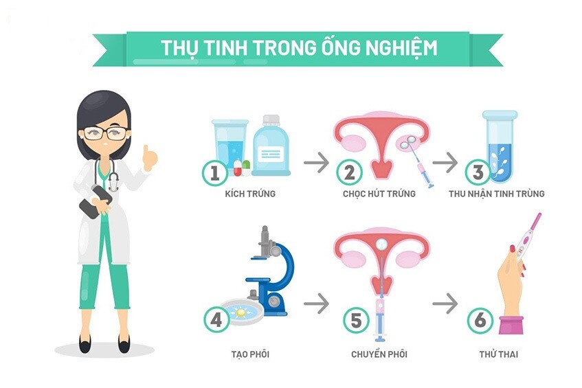 Đối tượng áp dụng và quy trình thực hiện thụ tinh nhân tạo IVF Ảnh minh họa
