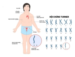 “Vô sinh có di truyền không?”[Bác sĩ giải đáp] Ảnh minh họa