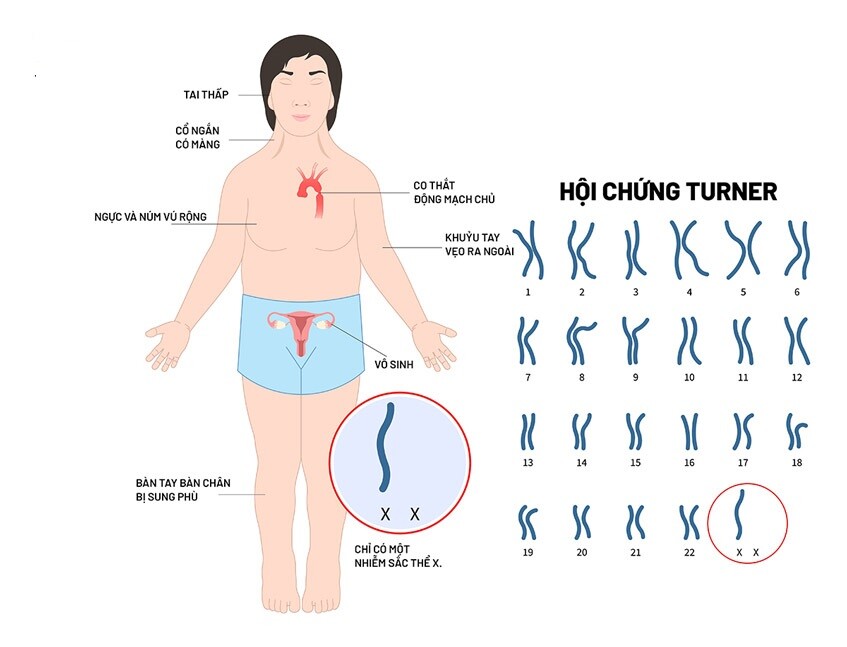 “Vô sinh có di truyền không?”[Bác sĩ giải đáp] Ảnh minh họa
