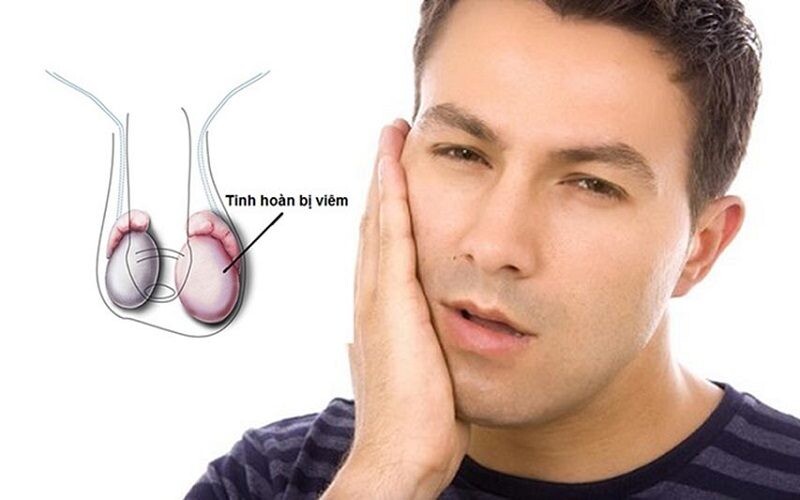 Vô sinh do biến chứng quai bị có chữa được không? Ảnh minh họa