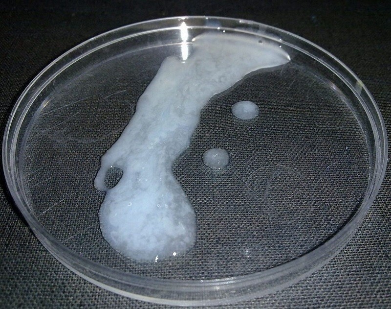 Tìm hiểu chi tiết vô sinh là gì? Vô sinh nguyên phát – vô sinh thứ phát là gì? Ảnh minh họa