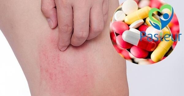 Dị ứng thuốc: Hiểu rõ để phòng ngừa và xử lý kịp thời Ảnh minh họa